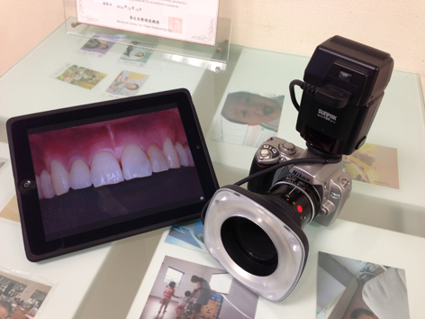 歯科用カメラ